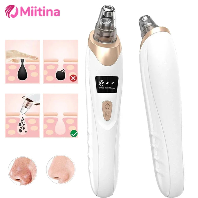 Revolutionize Your Skin Care Routine with Our Electric Blackhead Remover – USB Facial Pore Cleaner for Spotless Skin and Acne-Free Complexion!