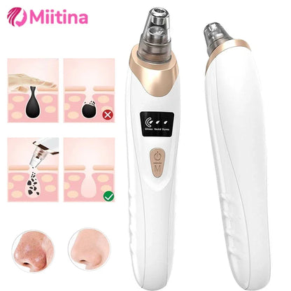 Revolutionize Your Skin Care Routine with Our Electric Blackhead Remover – USB Facial Pore Cleaner for Spotless Skin and Acne-Free Complexion!