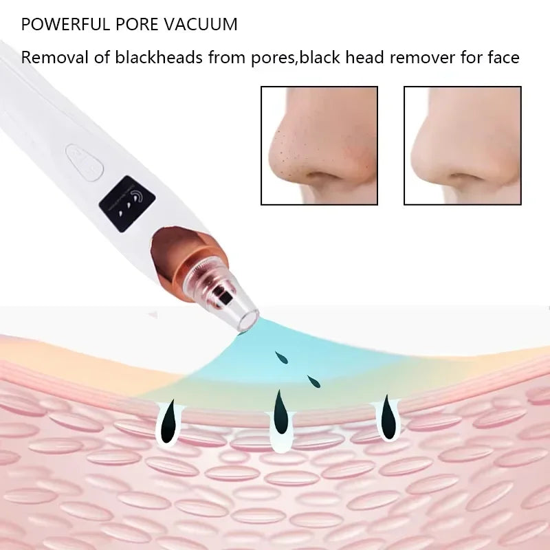 Revolutionize Your Skin Care Routine with Our Electric Blackhead Remover – USB Facial Pore Cleaner for Spotless Skin and Acne-Free Complexion!