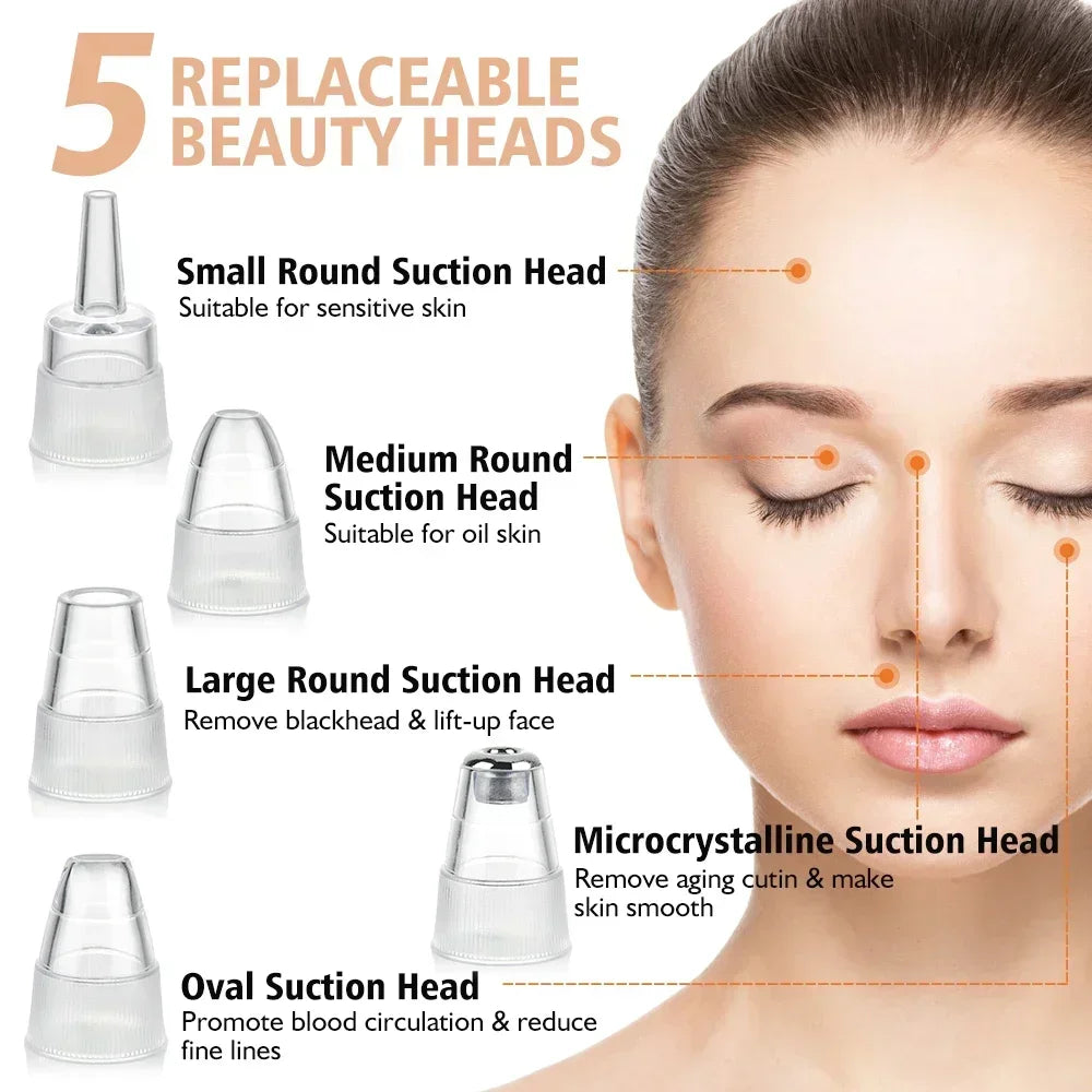 Revolutionize Your Skin Care Routine with Our Electric Blackhead Remover – USB Facial Pore Cleaner for Spotless Skin and Acne-Free Complexion!