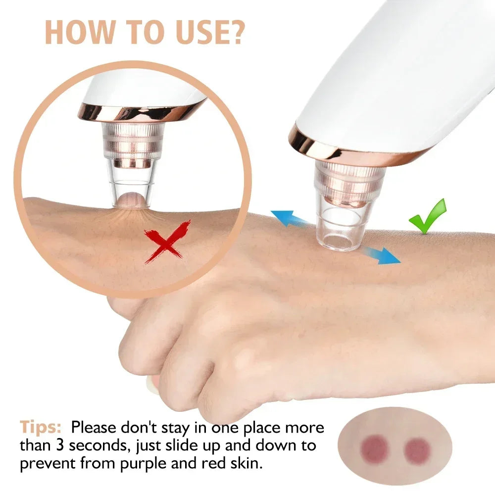 Revolutionize Your Skin Care Routine with Our Electric Blackhead Remover – USB Facial Pore Cleaner for Spotless Skin and Acne-Free Complexion!